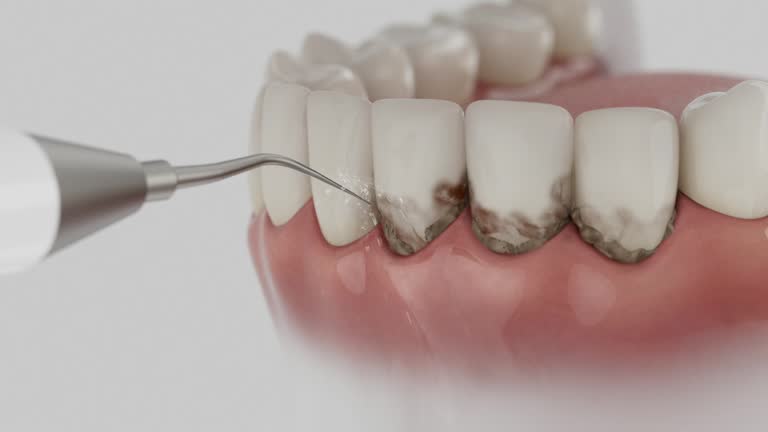 Reliable Dental Implants contractor in Alamo, GA by Smile Center Dentistry